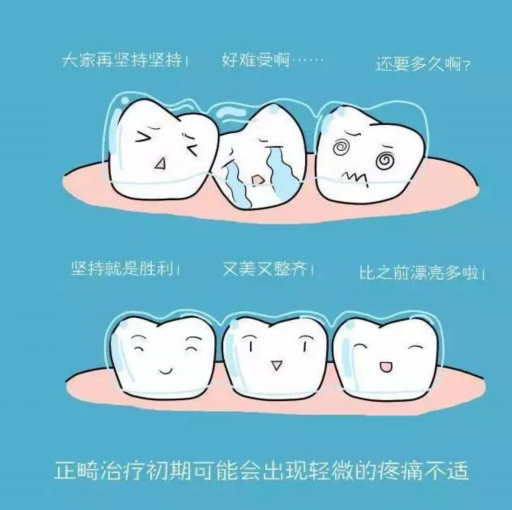为什么有的拔牙手术需要全麻（拔牙的全麻和做手术的全麻一样吗）